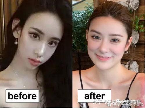 明星去哪里整容,揭秘他们变美的神秘之地